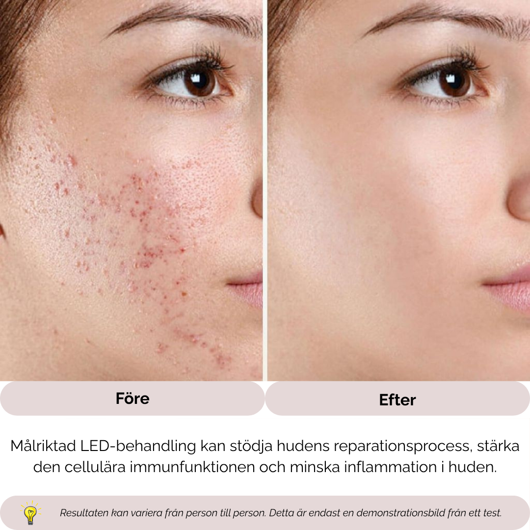 HotGlow™ – Ansiktsmassage & Ljusterapi för Inre och Yttre Ljus