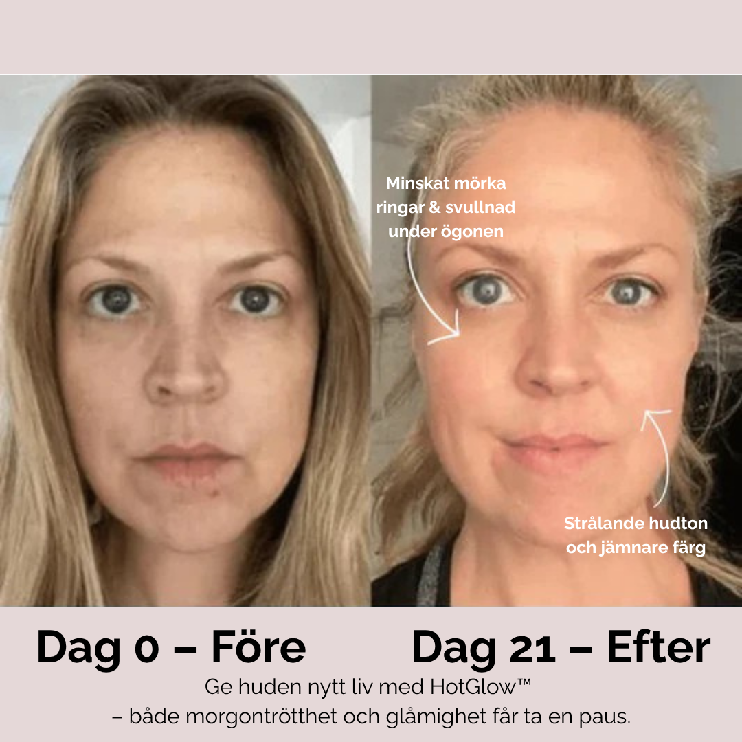 HotGlow™ – Ansiktsmassage & Ljusterapi för Inre och Yttre Ljus