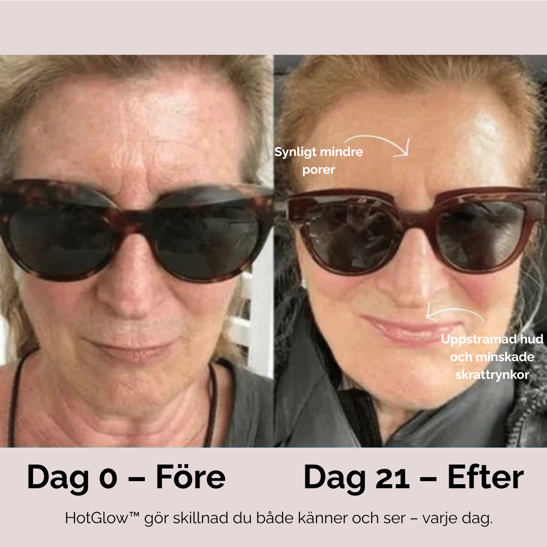 HotGlow™ – Ansiktsmassage & Ljusterapi för Inre och Yttre Ljus