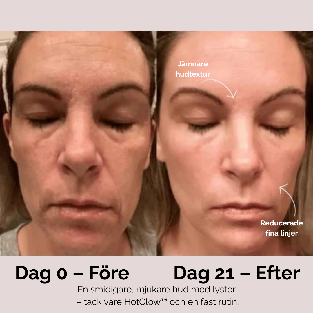 HotGlow™ – Ansiktsmassage & Ljusterapi för Inre och Yttre Ljus